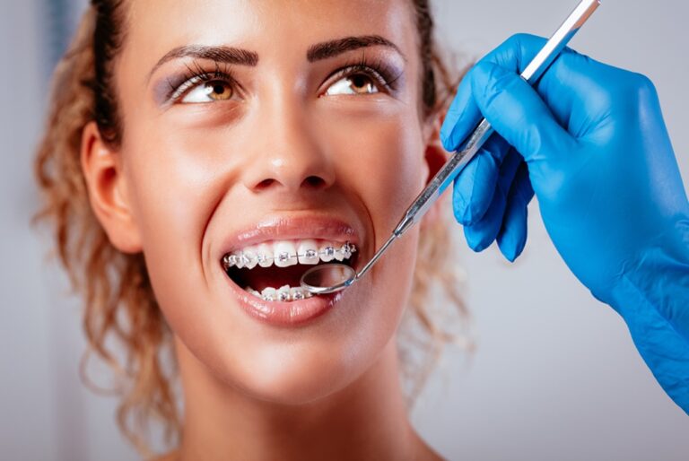 What To Do The Day Before Getting Braces