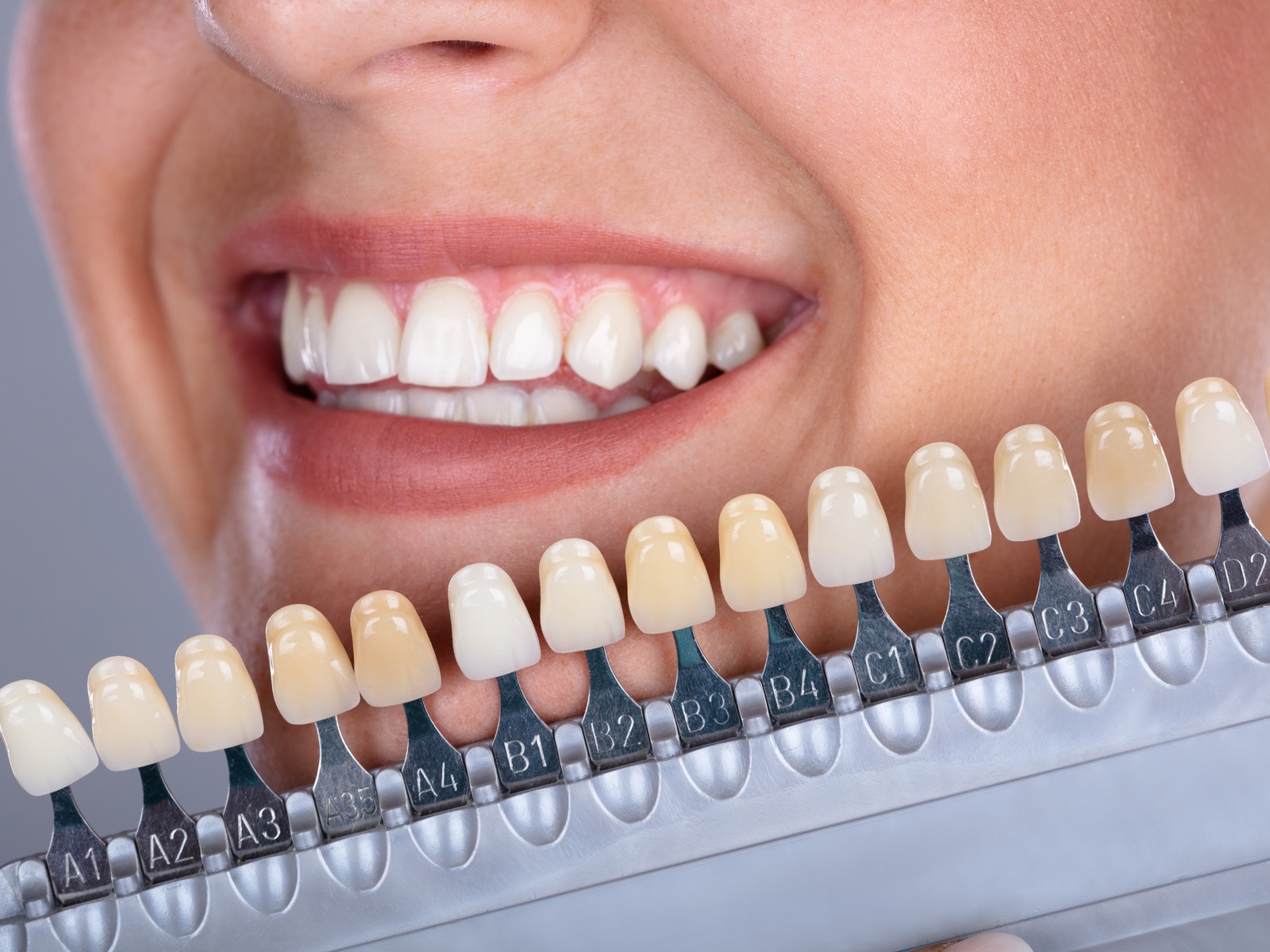 What is Dental Aesthetics?