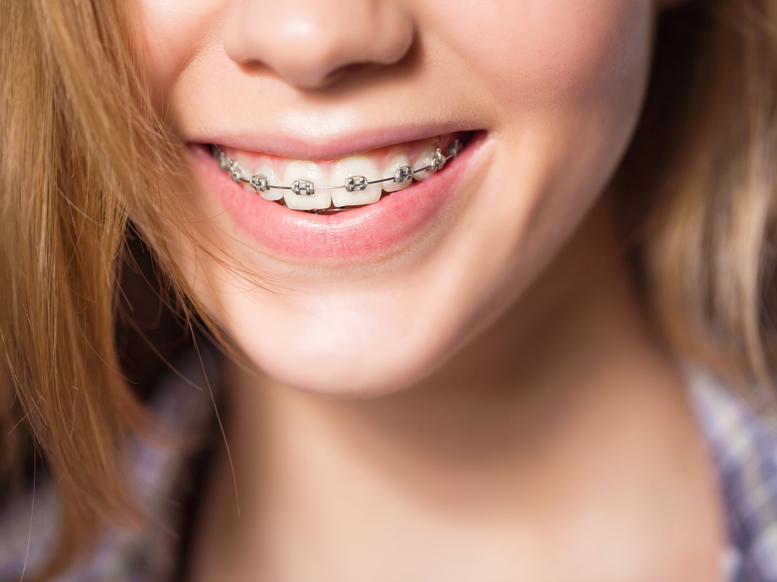 What is the best age for braces?