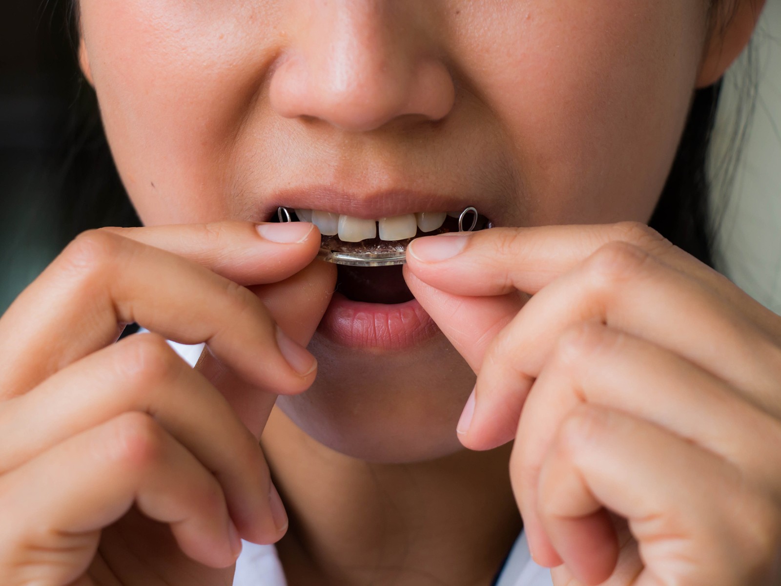 What happens when you stop wearing retainers?