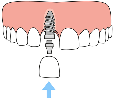 Dentist in 77433 TX