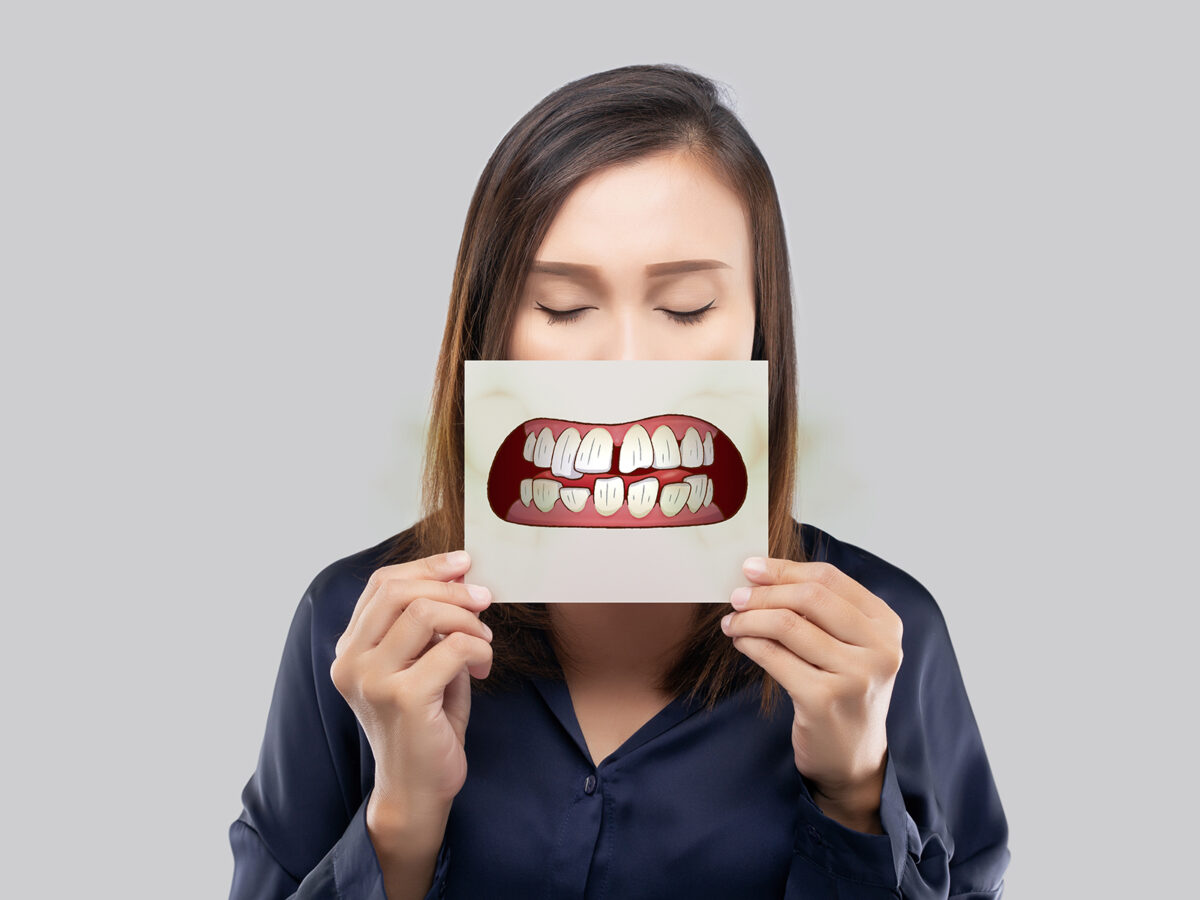 Different Types of Teeth Alignment Problems