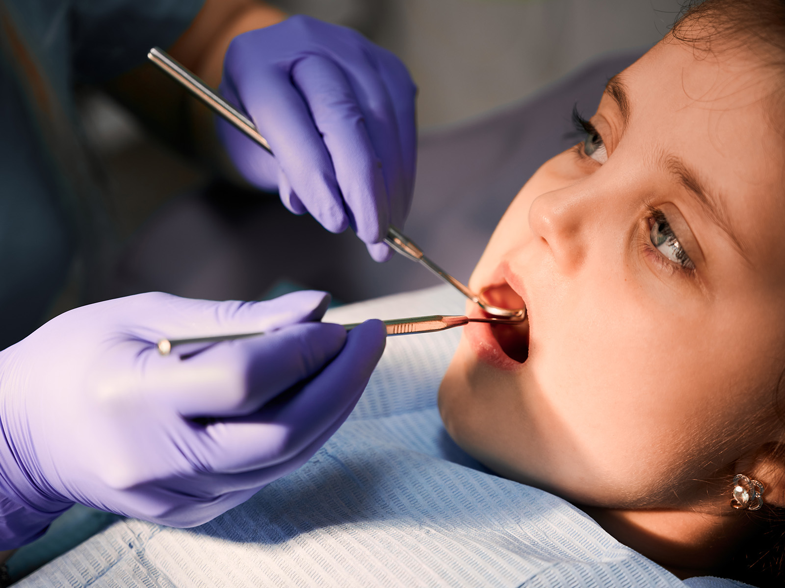 When Should You Consider Dental Sealants For Your Child?
