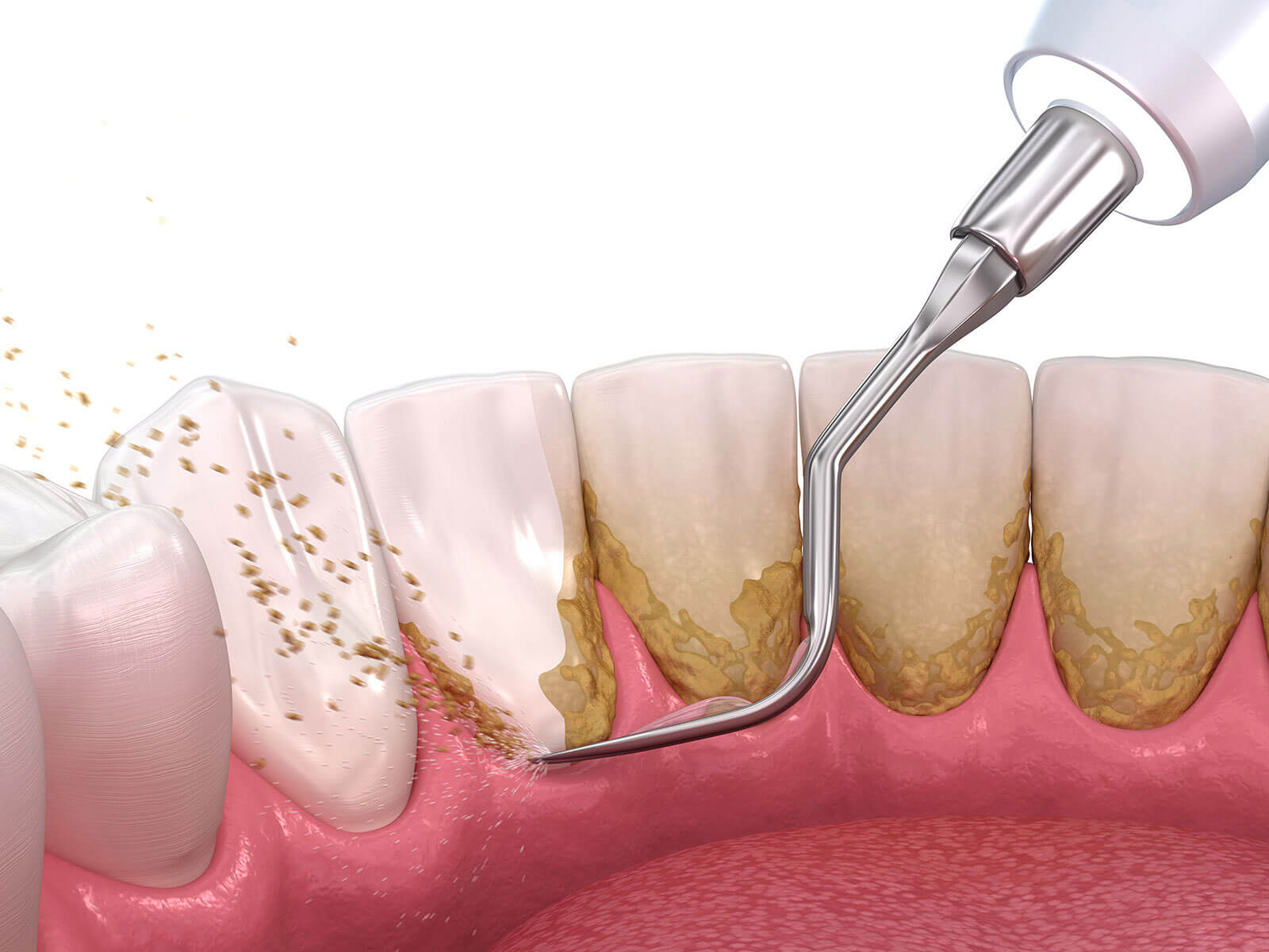 A Comprehensive Guide To Teeth