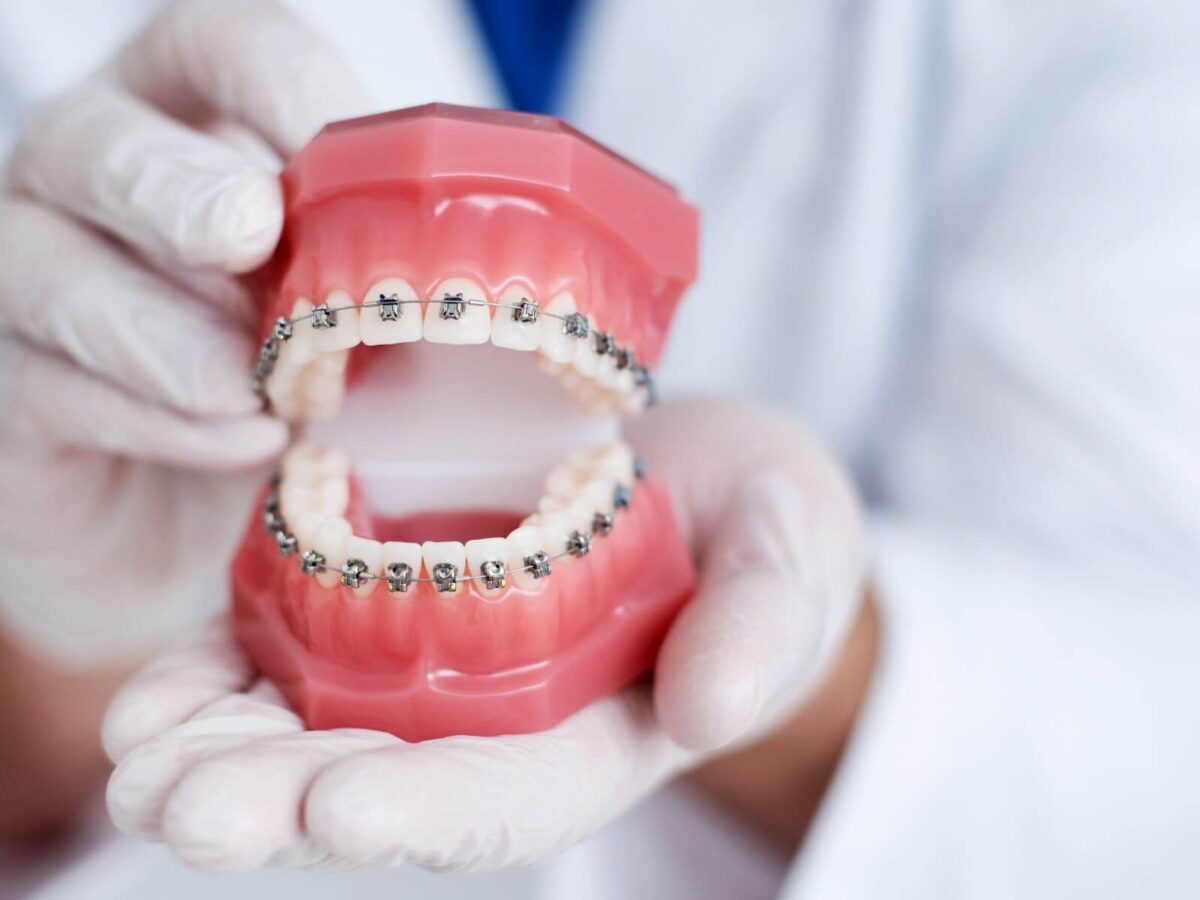 Dietary Tips For Kids with Braces