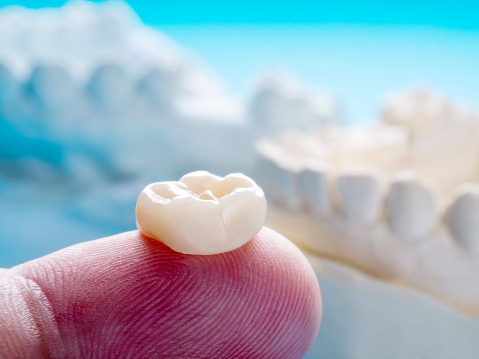 5 Signs You May Need A Dental Crown