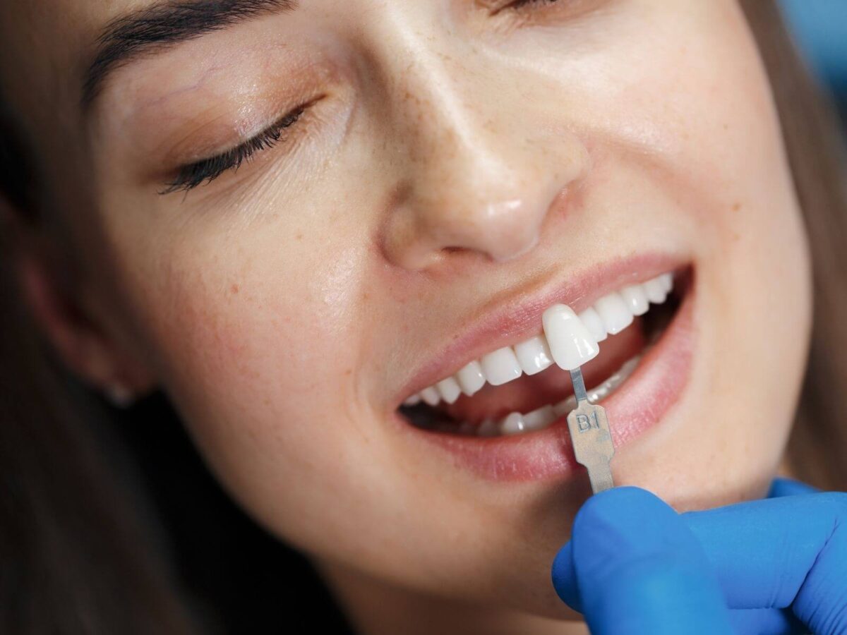 Why Veneer Shape And Size Matter For Your Face