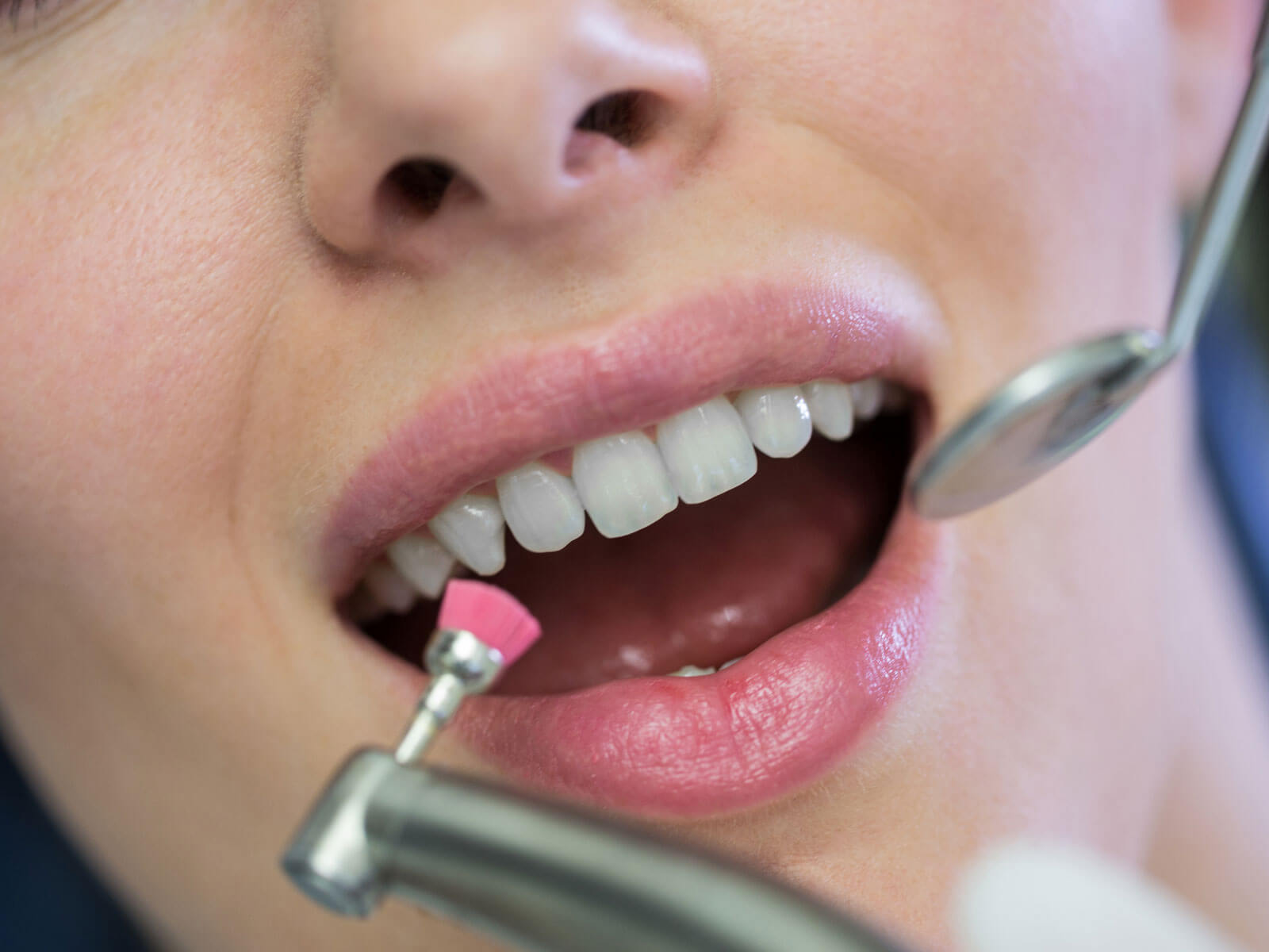 Does Dental Cleaning Damage Tooth Enamel?