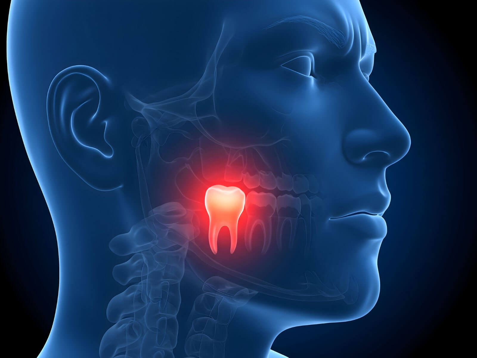 Does Everyone Develop Wisdom Teeth?